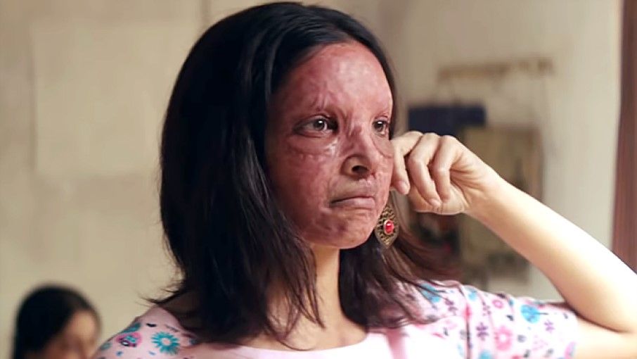 ‘छपाक’ का विरोध एसिड अटैक पीड़िताओं के जख्मों पर नमक छिड़कने जैसा